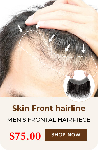 MEN'S FRONTAL HAIRPIECE