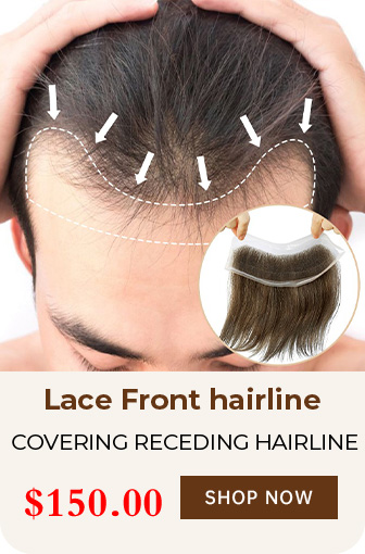 COVERING RECEDING HAIRLINE